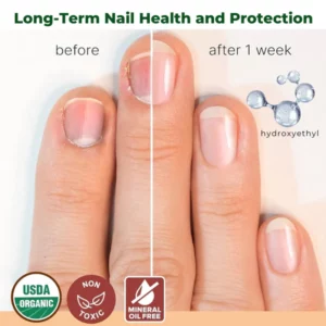 Fivfivgo™ NailNurture Bee Venom Fungus Treatment Oil