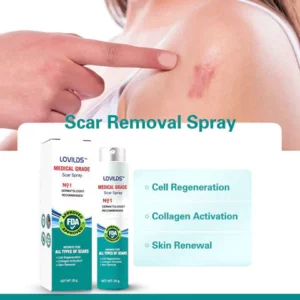 LOVILDS™ Advanced Scar Spray For All Types of Scars