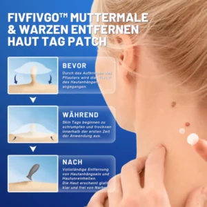 Fivfivgo™ Moles & Warts Removal Skin Tag Patch