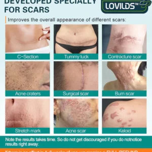 LOVILDS™ Advanced Scar Spray For All Types of Scars