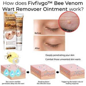 Fivfivgo™ Bee Venom Wart Remover Ointment