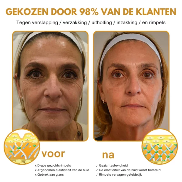 Anti-Wrinkle™ | Botox Wrinkle Removal Cream