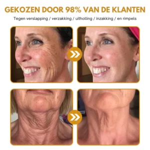 Anti-Wrinkle™ | Botox Wrinkle Removal Cream