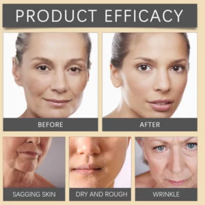 Furzero Botox™ Achieve a natural Botox effect