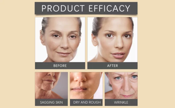 Furzero Botox™ Achieve a natural Botox effect